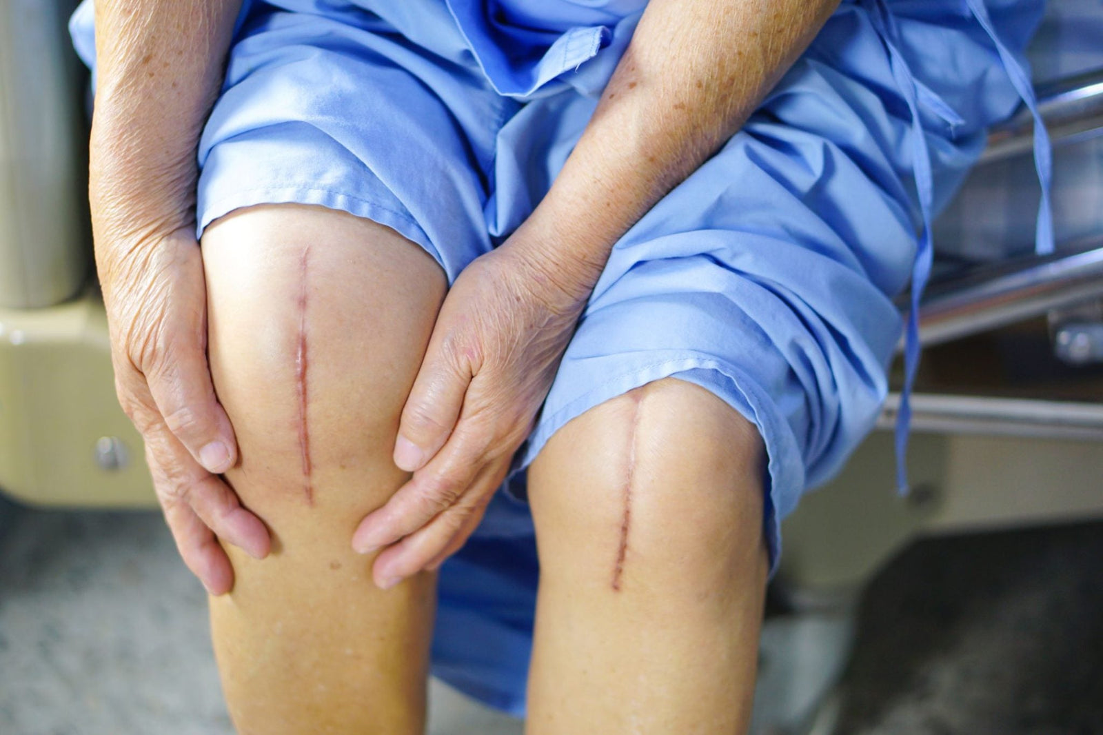 Avoid These 6 Common Mistakes After Knee Replacement Surgery for Optimal Recovery