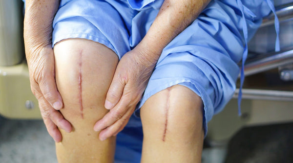 Avoid These 6 Common Mistakes After Knee Replacement Surgery for Optimal Recovery