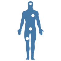 <h3>Reduces pressure points, prevents bone-on-bone</h3>